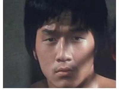 探尋小巷中的美麗秘密，割雙眼皮的價(jià)格是否昂貴？